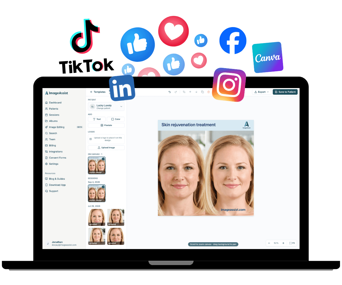 The ImageAssist Image Editor with a before-and-after post ready for social channels
