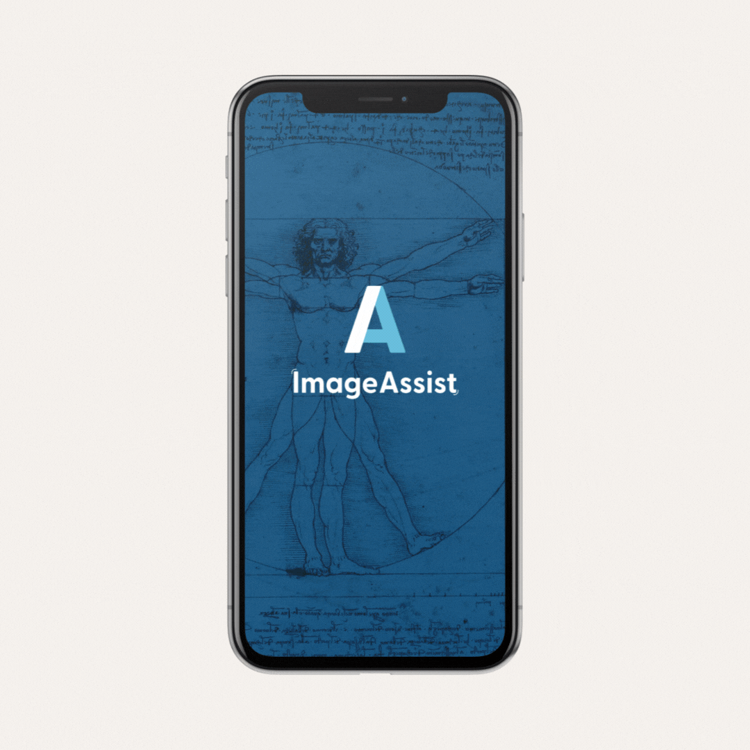 SmartGuides Technology